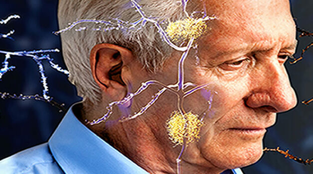 Eet vlees om Alzheimer te voorkomen